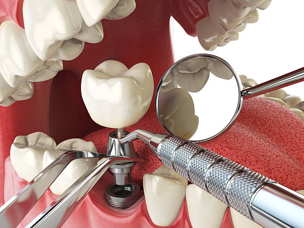 Best Emergency Treatment for Oral Infections in Morrisville, VT